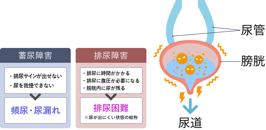 尿機能トラブルの画像